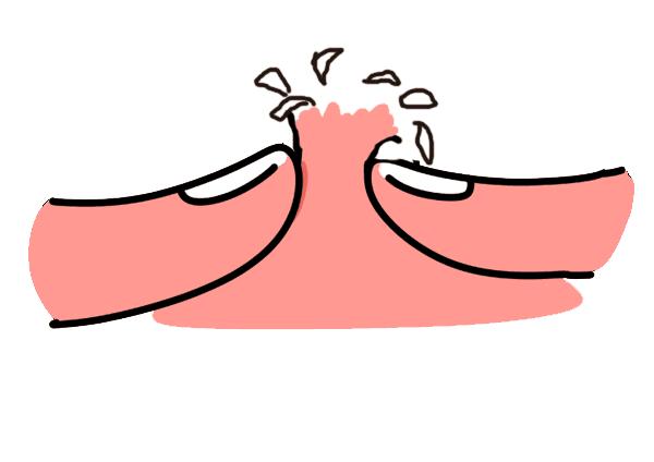 闭口烂脸的解决方法,脸部闭口怎么彻底解决