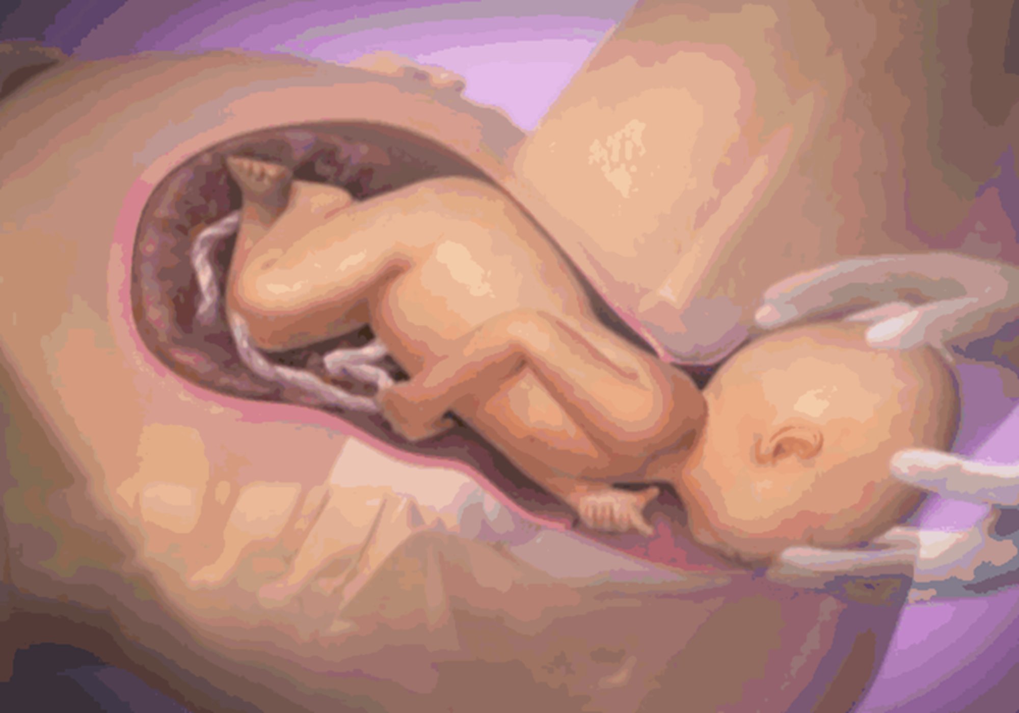 怎么避免顺产时拉粑粑,顺产生孩子最尴尬的事