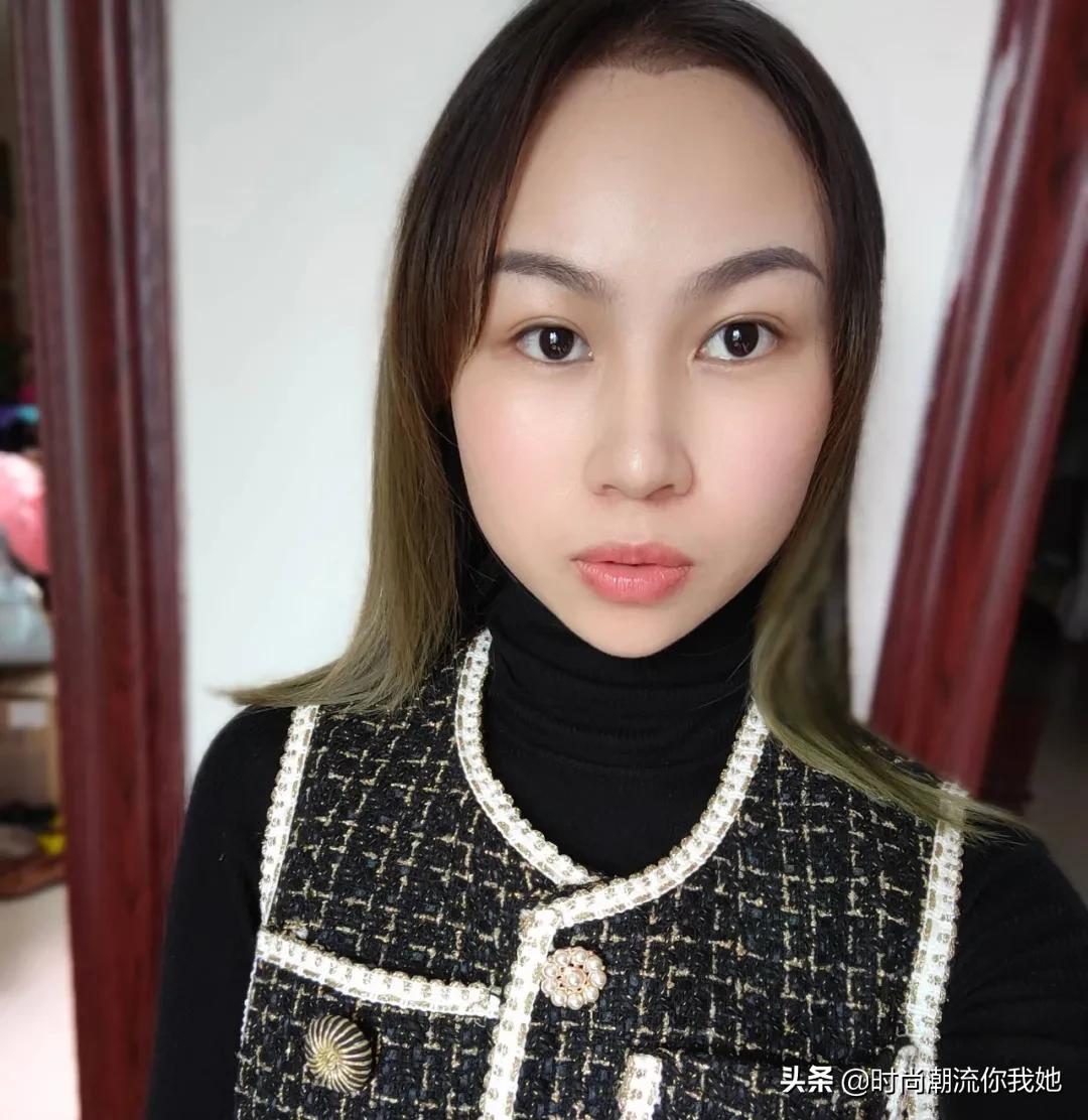 单眼皮凸嘴素人改造,肿眼泡整容成功案例