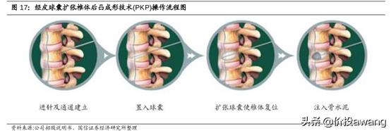 凯利泰与高瓴,凯利泰高瓴战略投资需批准吗