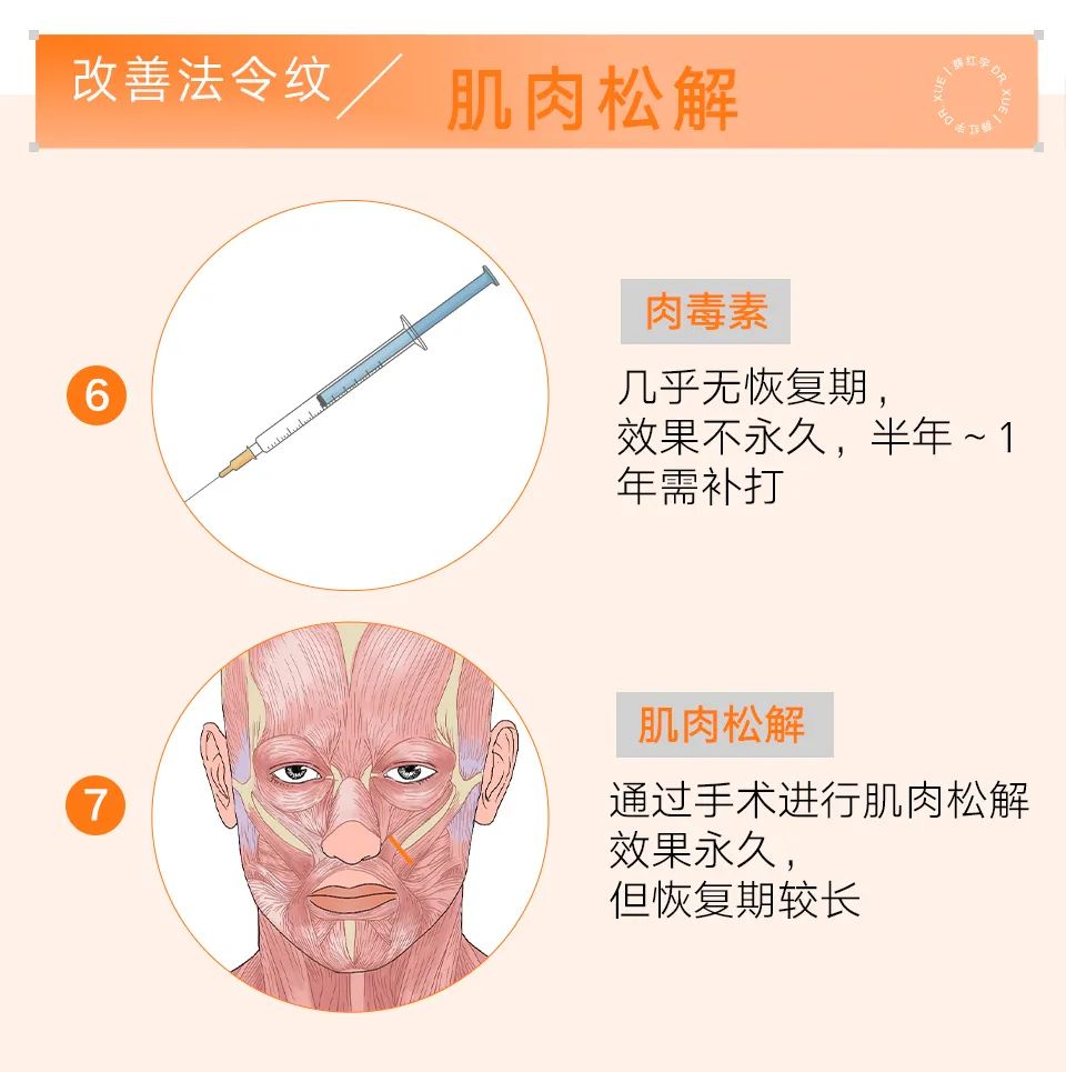 脾胃好了法令纹会改善吗,面部瑜伽能改善法令纹吗