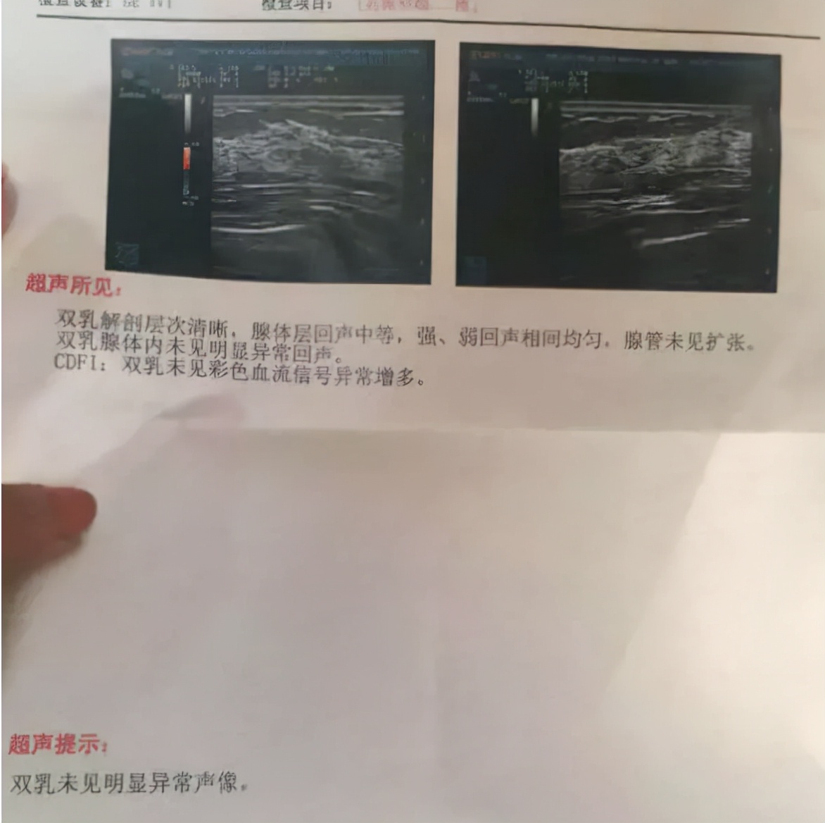 乳房结节切除,看似一劳永逸的手术,实则是将患者“画地为牢”