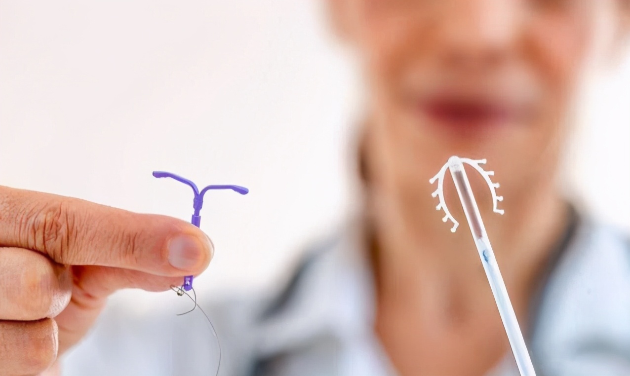 放了环后取环不孕,上了节育环6年后取出一直不孕