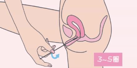 已婚女性定期应该做哪些检查,女人有没有性疾病查什么项目