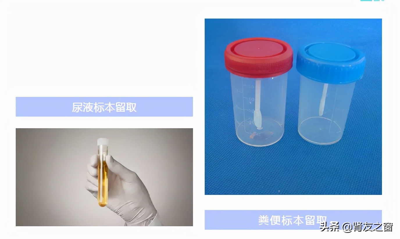 体检前的注意事项,糖友基础体检项目做了哪些