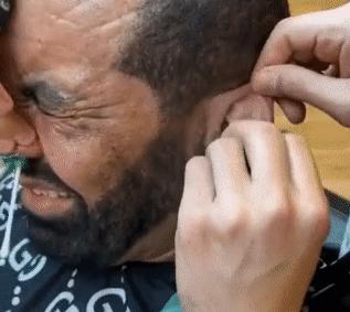 毛发脱毛,哪种脱毛才是永久性脱毛