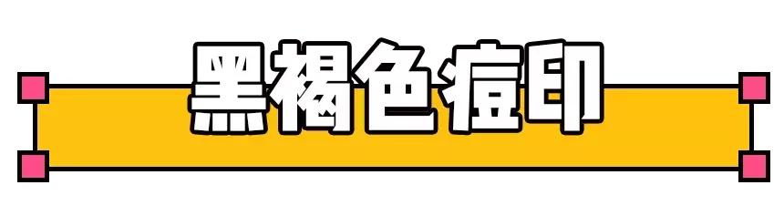库博士祛痘怎么收费,库博士专业祛痘怎么样