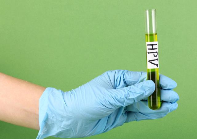 tct和hpv检查哪个确诊宫颈癌,hpvtcp检查