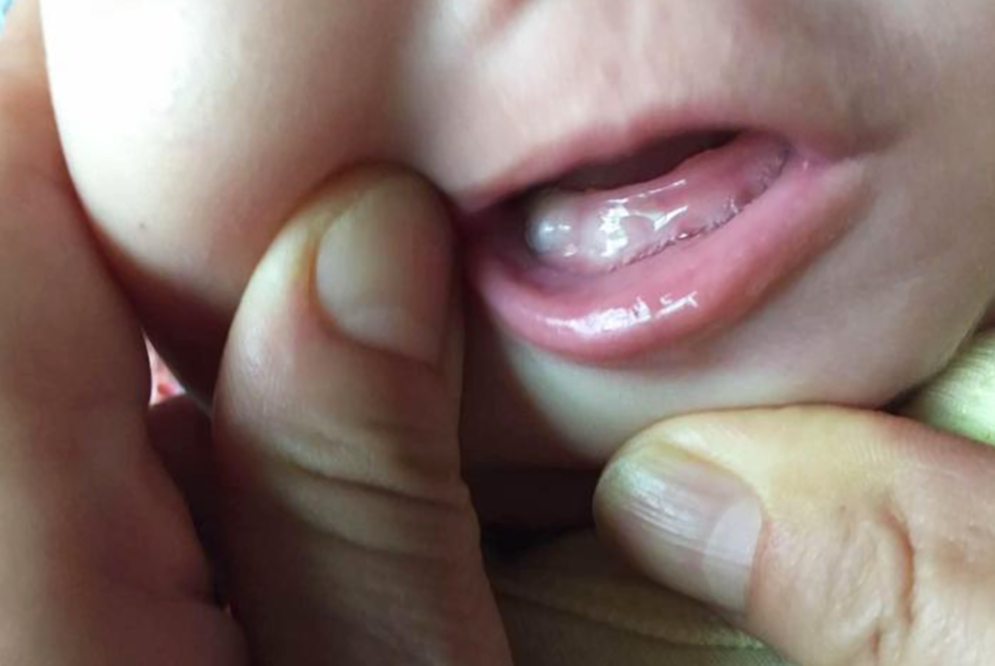 宝宝出牙早晚和咀嚼发育有关,安排好辅食添加,牙齿才能长得好