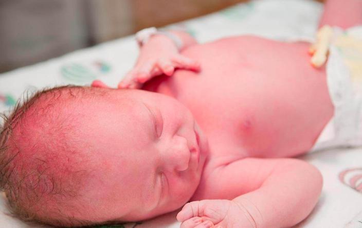 为什么宝宝出生后会有黄疸?什么情况需要住院?新生儿黄疸全解读