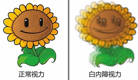 白内障到底是什么！你了解白内障吗？