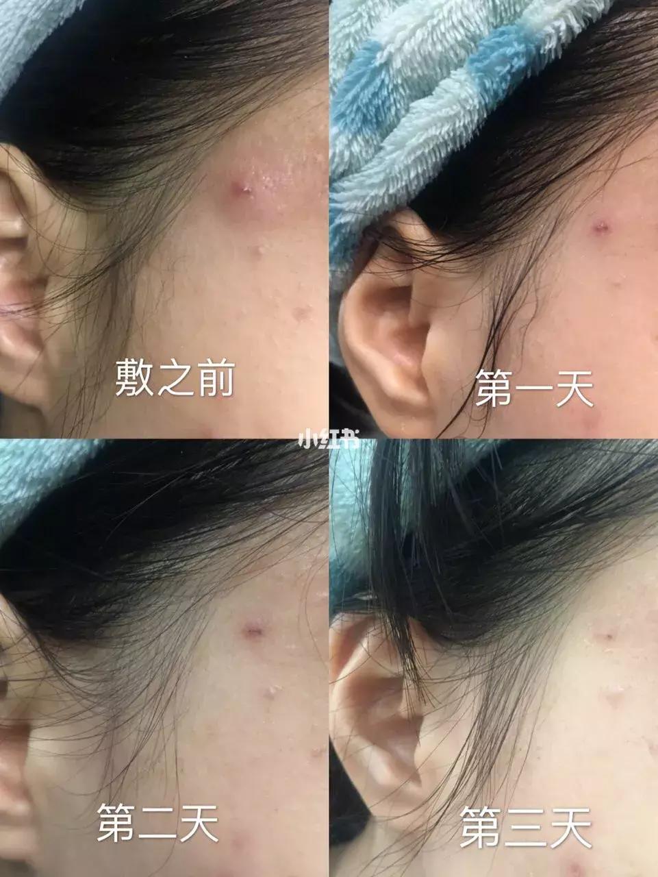 医美爆款面膜,公认最好用的10大网红面膜