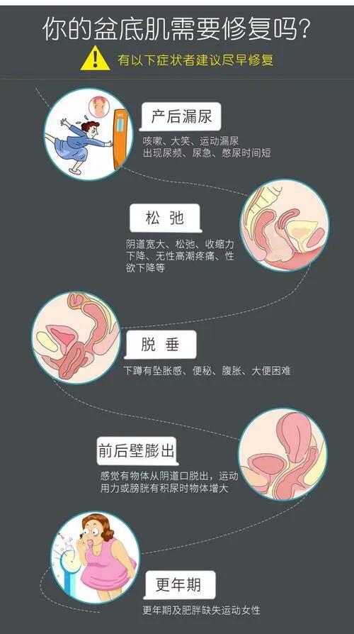 生娃后最尴尬的事,生完孩子尴尬的问题