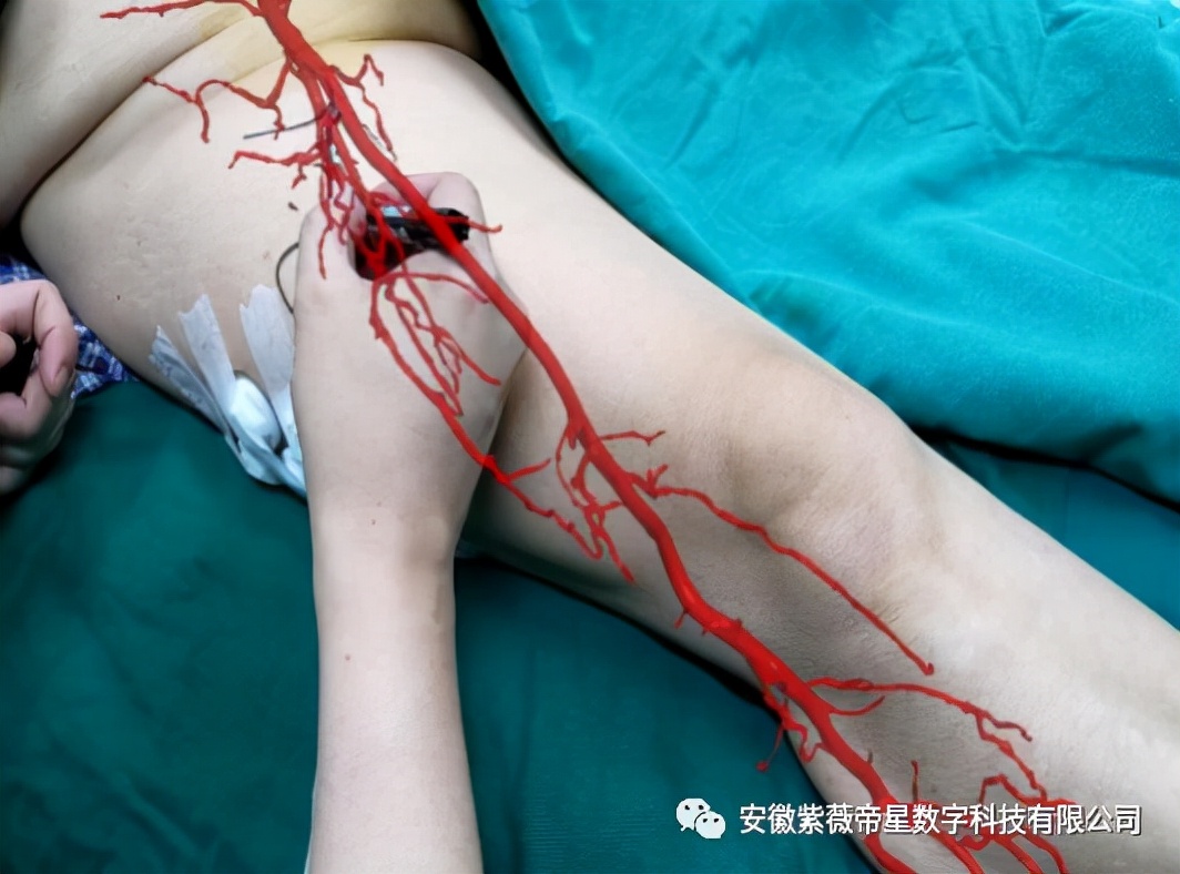 绵阳市第三人民医院甲状腺外科,绵阳三医院甲状腺外科