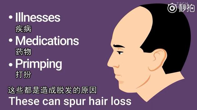 小贝热搜,小贝脱发