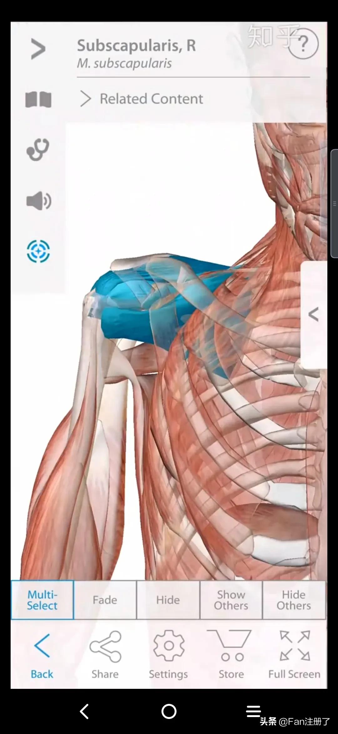 肩痛肩袖损伤针刀治疗,肩痛肩关节活动受限用什么药