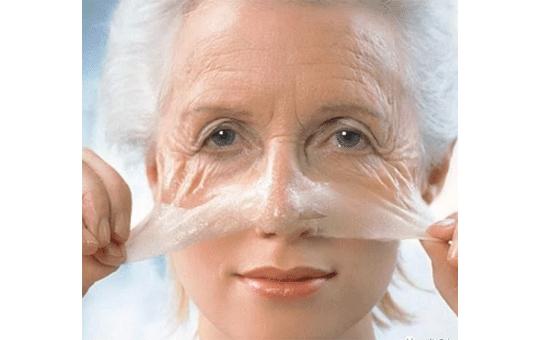 做小拉皮手术多久能恢复,做拉皮手术十年以后会变成什么