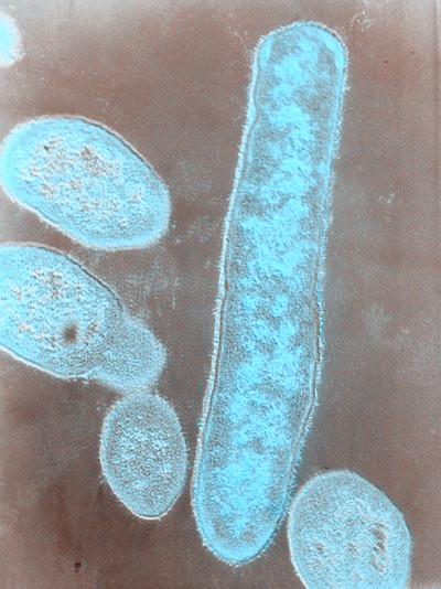 生物可降解塑料前景,生物可降解塑料是什么原料