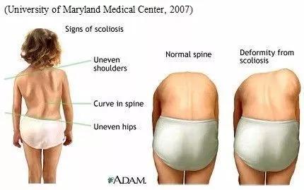 德国变态黑科技靠垫，两侧怀抱设计，分散体压，使脊椎不受压迫