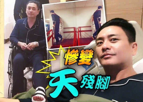 黄宗泽拐杖湖南卫视,黄宗泽拄拐