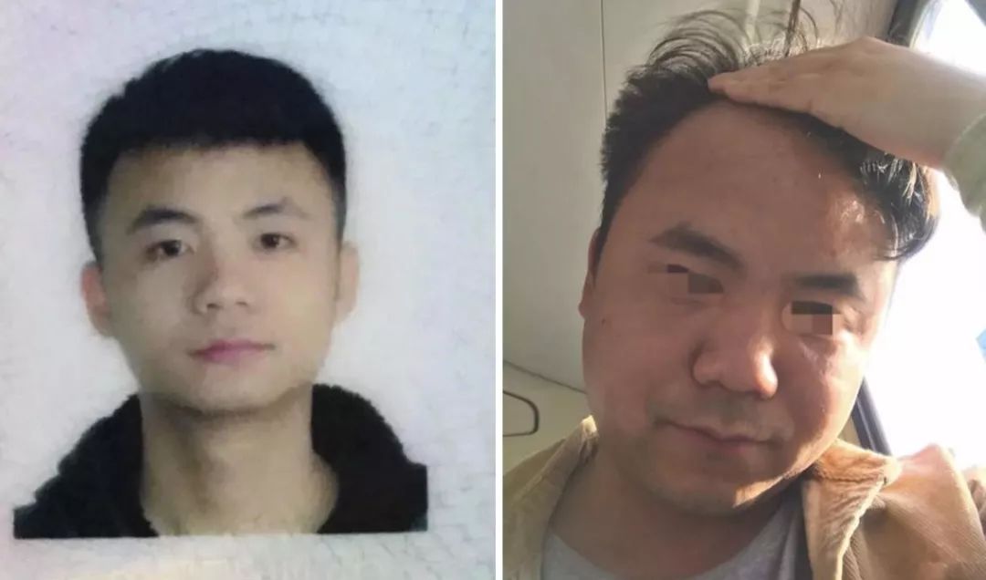 癌症晚期突然张嘴睡觉还能撑多久,癌症病人晚期晚上不睡觉怎么回事