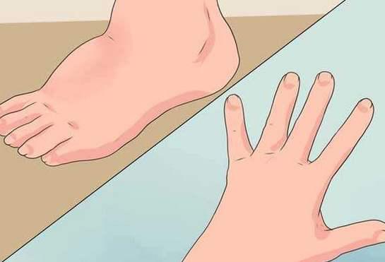 孕晚期腰疼健身操,孕晚期缓解腰疼操