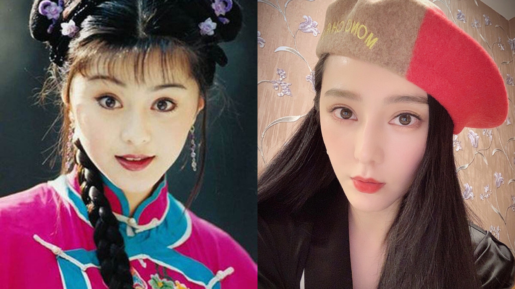 超声刀热玛吉都是什么仪器,医美小课堂热玛吉和超声刀区别