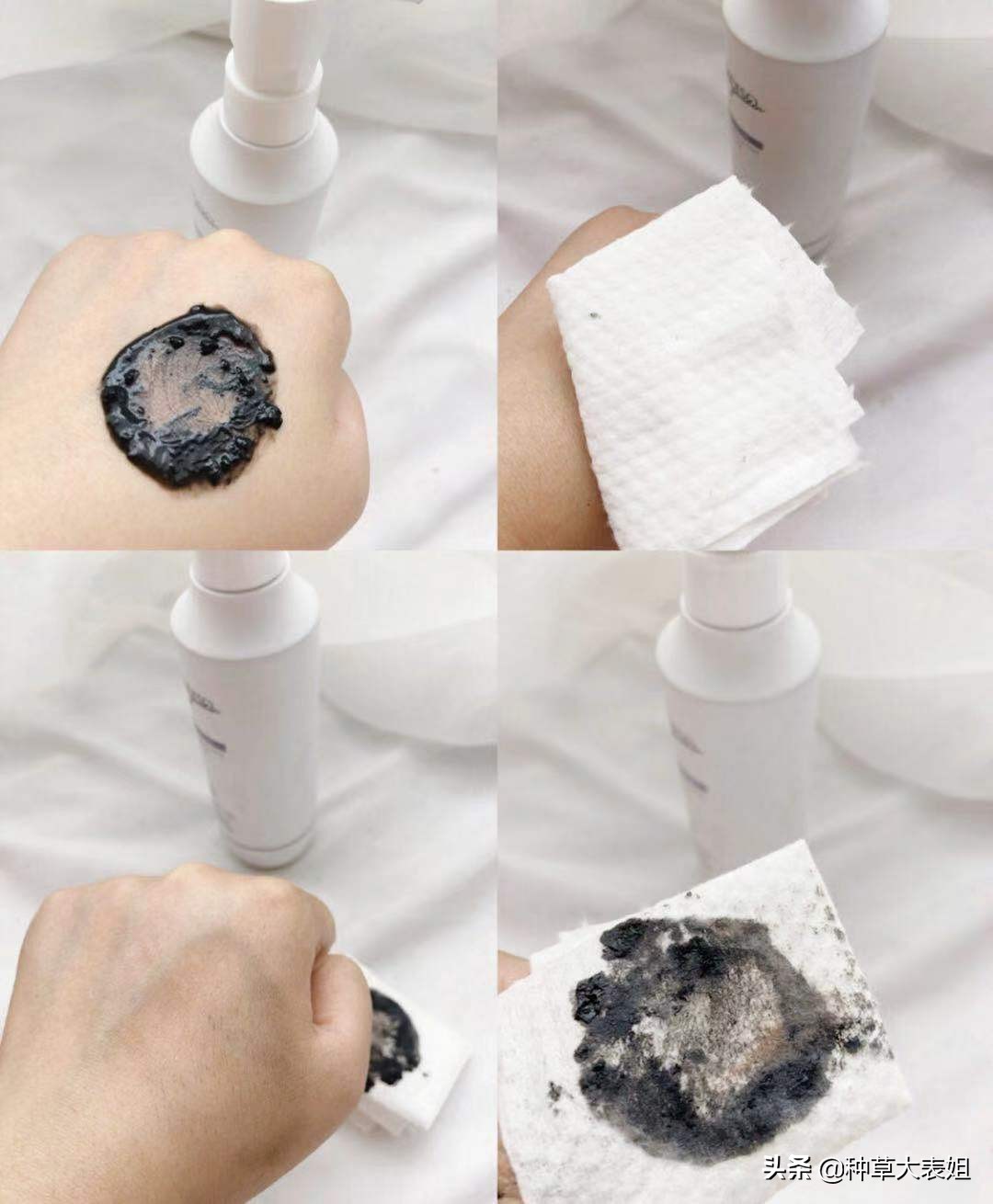 双十一必买水乳油痘肌,双11必买卸妆水