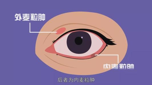 儿童眼睛长针眼是怎么回事,容易长针眼是什么原因