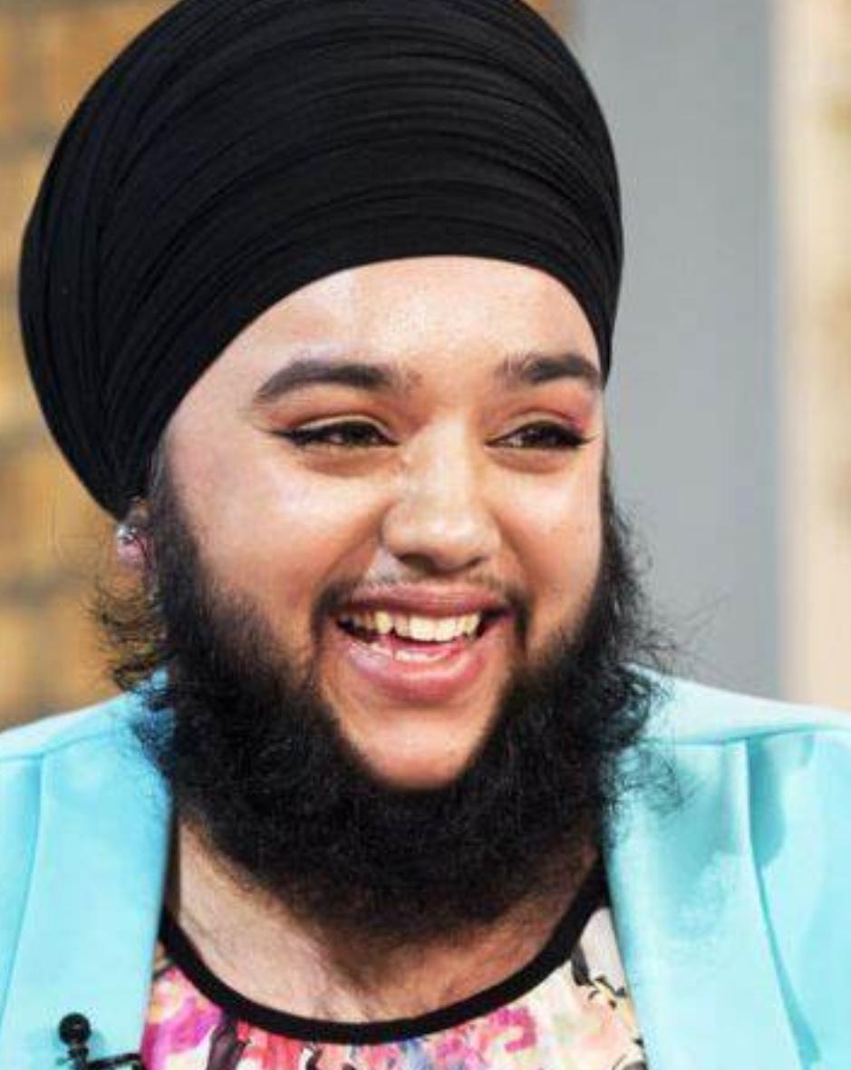 意大利女子牙龈长出睫毛状毛发,历经8年未治愈,病因很常见