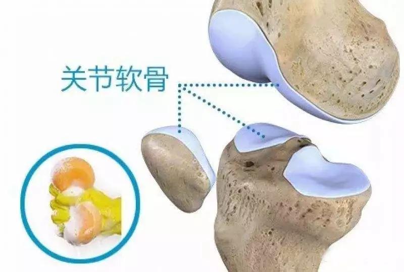 干细胞治疗膝关节软骨缺损,干细胞注射膝关节可以修复软骨吗