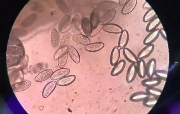 宝宝总是挠屁股挠腿怎么办,宝宝总是挠屁股是不是有虫