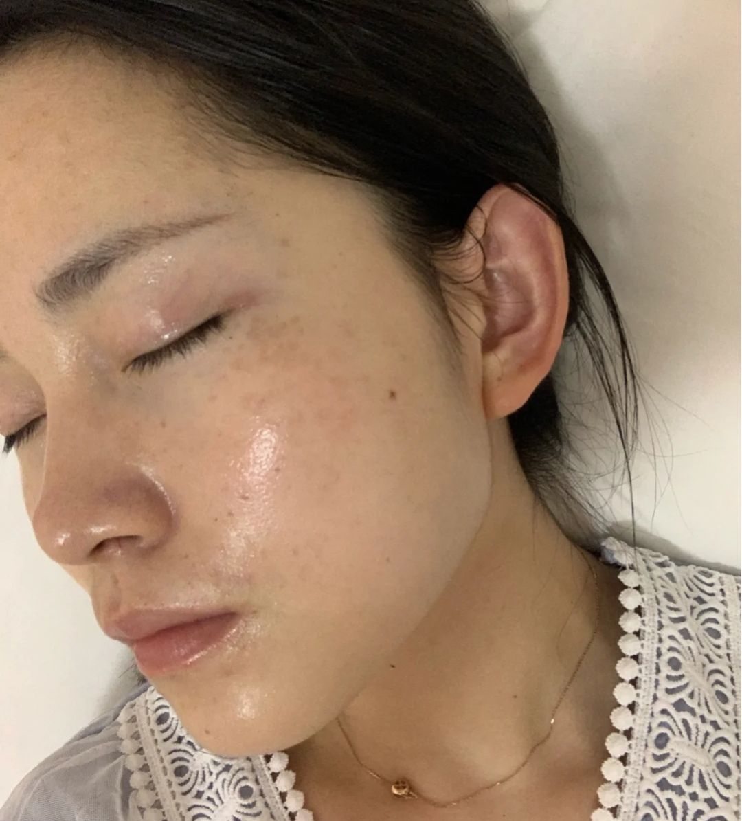 油性皮肤更抗衰老吗,油性皮肤保湿有用吗