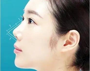 全世界公认的最有效的瘦鼻法,短鼻和扁平鼻的区别
