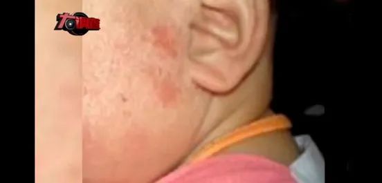 郴州大头娃娃,郴州大头娃娃事件真实原因