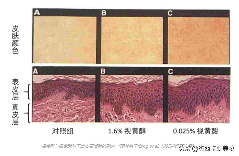 网红抗皱的功能成分视黄醇最全面的科普来了,教你怎么用好它