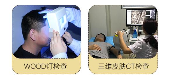 身上起小白点是什么原因怎么治,身上有一块白斑汗毛也是白的