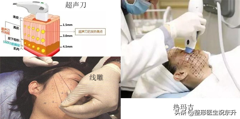 嘴角两旁的嘟嘟肉怎么去除,如何改善嘴角嘟嘟肉