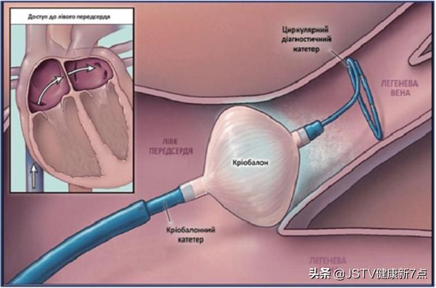 南京鼓楼内科专家门诊,北京鼓楼治疗房颤专家