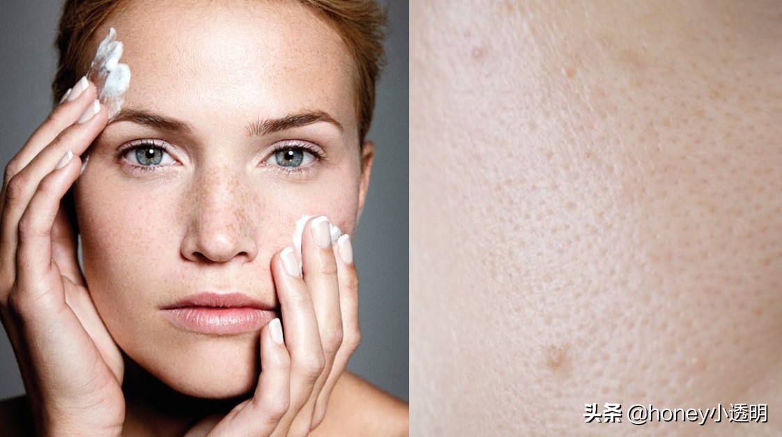收缩毛孔精华液改善毛孔粗大,毛孔粗大用什么收缩毛孔精华
