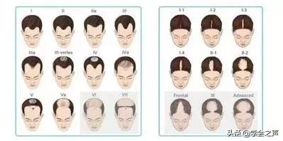 亲测有效的防脱发小技巧,脱发严重这个防脱发妙招很好用