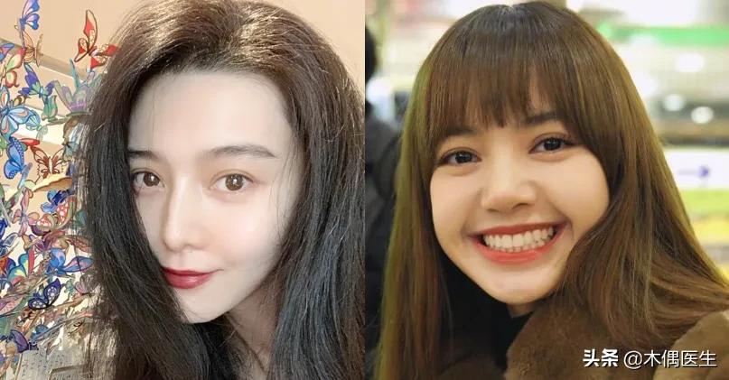 侧面鼻子很挺正面很塌,怎样判断鼻子的塌与挺