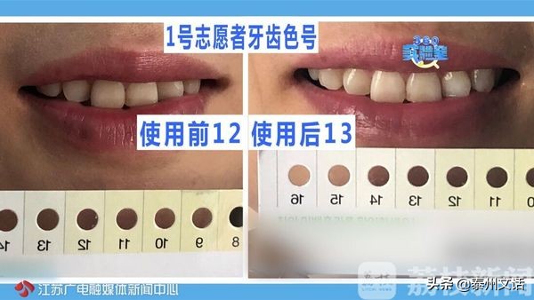 超强美白牙贴,网红美白牙笔有没有用