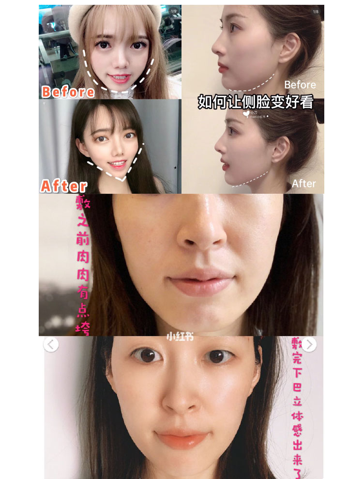 riazul鐦﹁劯琛ユ按闈㈣啘,riazul琛ユ按闈㈣啘