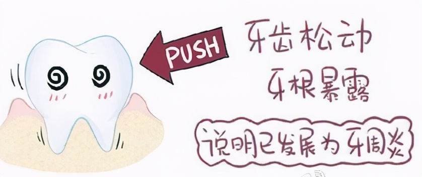 科普牙齿口腔知识,牙周病怎么治疗