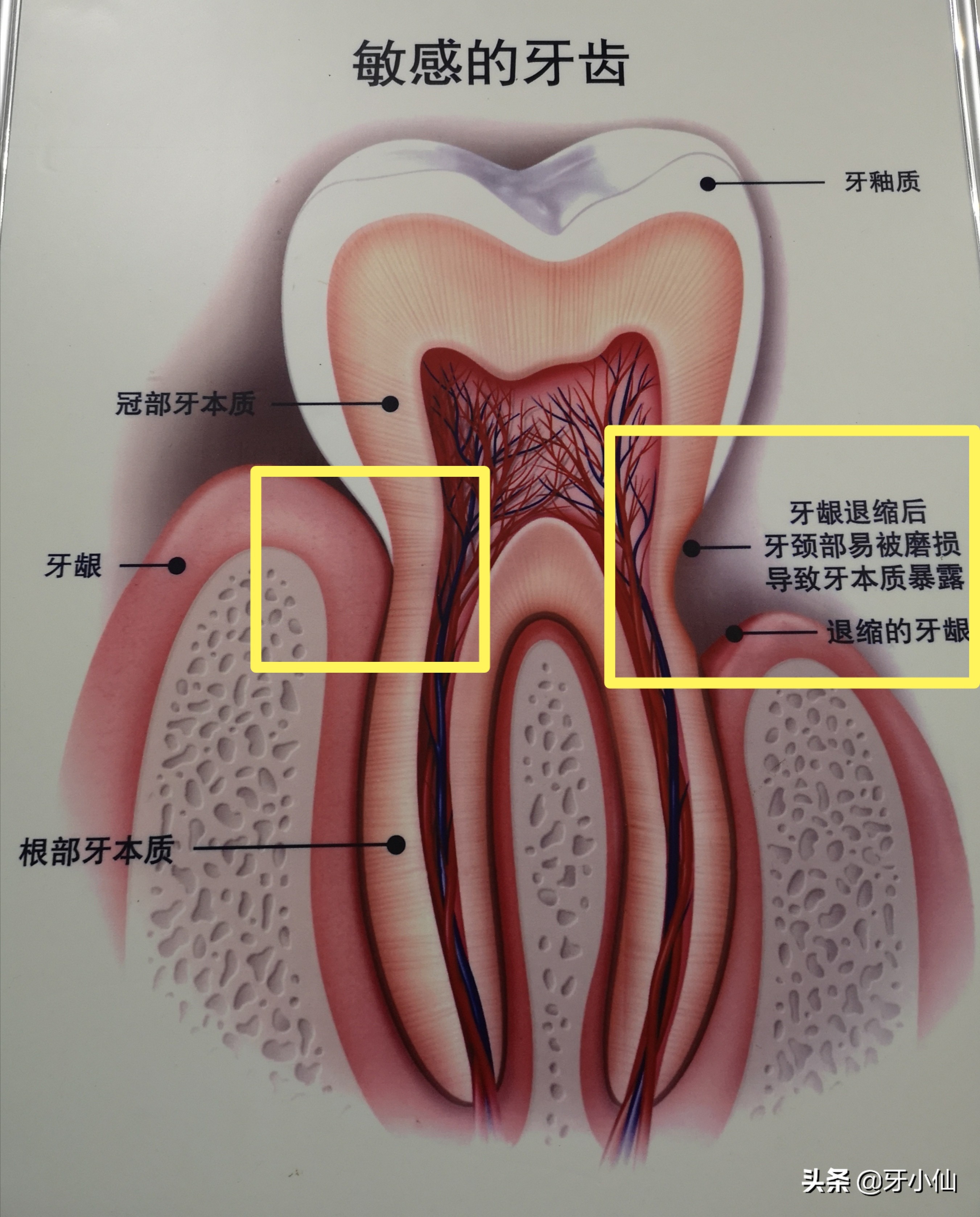 牙太痛,吃不了热辣火锅、冰爽雪糕、酸甜水果,怎么能当吃货?