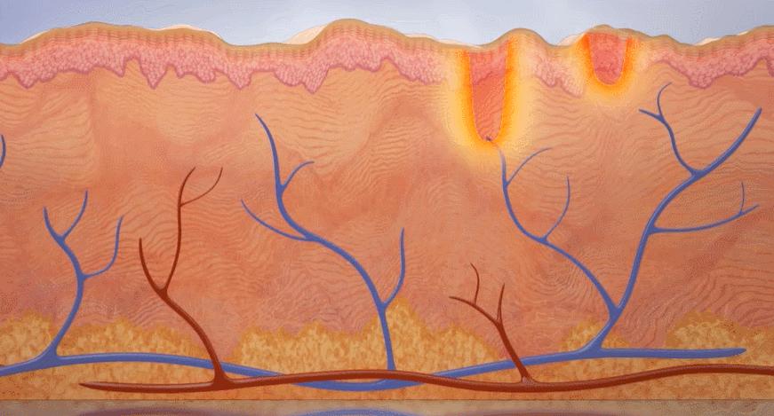 毛孔粗大到底怎么办才好,毛孔粗大治不好了吧