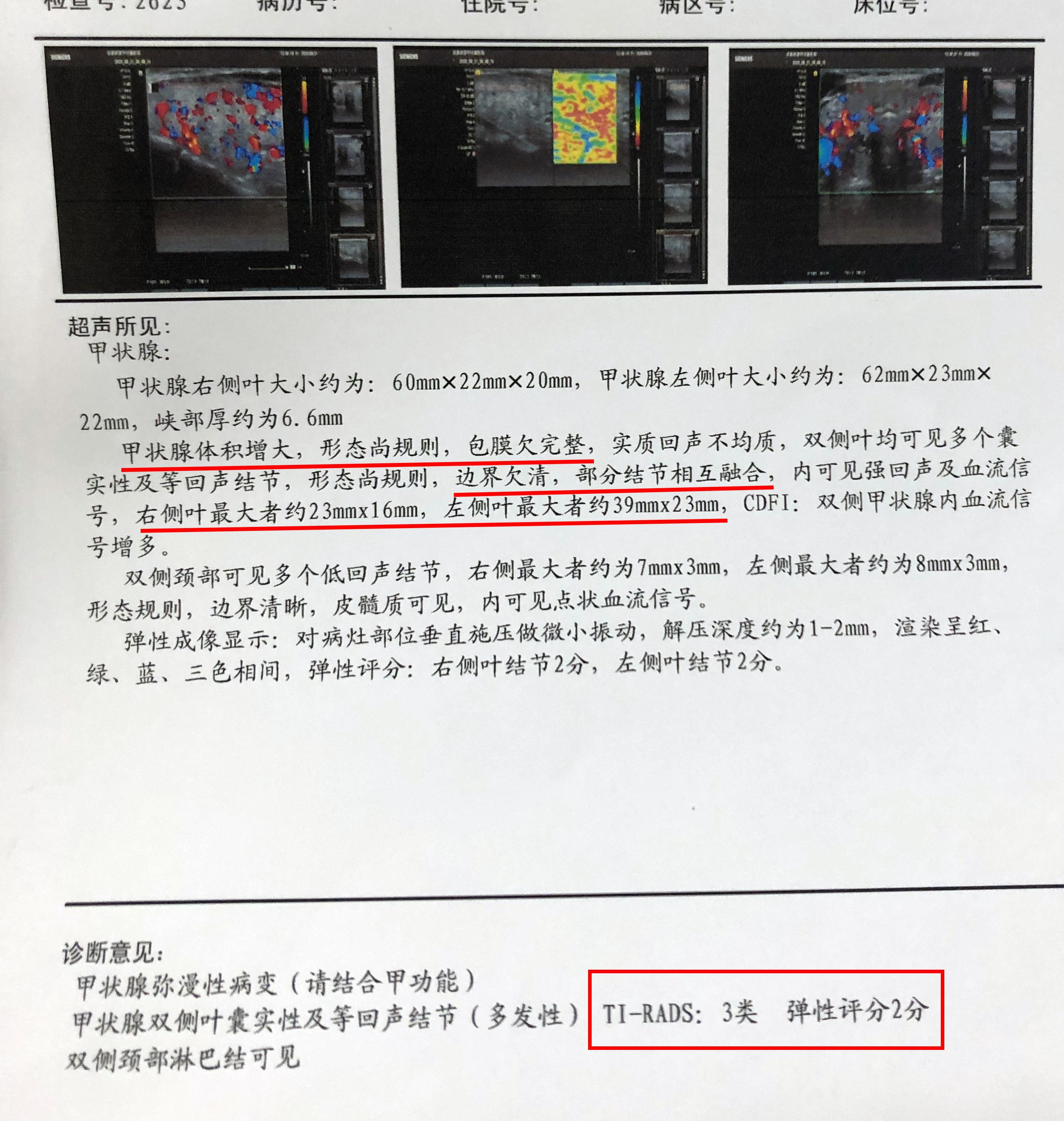真实案例：警惕建筑材料中致病因素！患者3.9cm甲状腺结节已融合