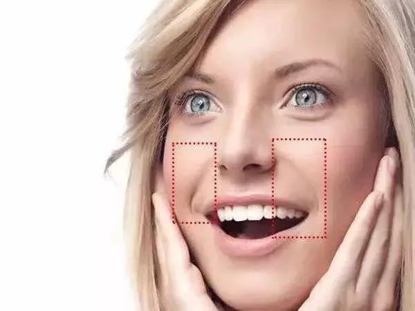 34岁的女性就有法令纹了怎么治愈,怎么让法令纹变细嫩