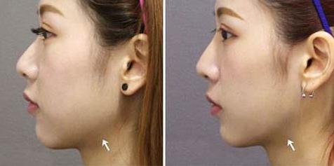 小米有品击穿行业暴利!179元有1999的质量,日本销量王:搞我?